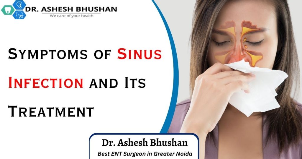 Symptoms of Sinus Infection and Its Treatment-Dr. Ashesh Bhushan