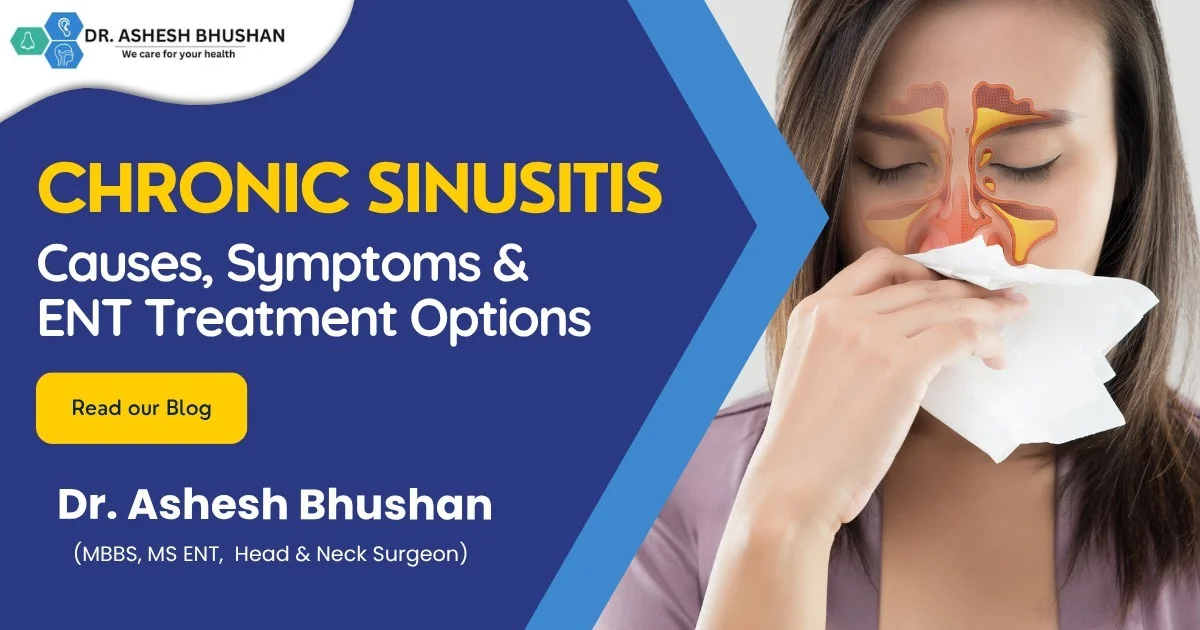Chronic Sinusitis Treatment by Dr. Ashesh Bhushan Causes & Symptoms